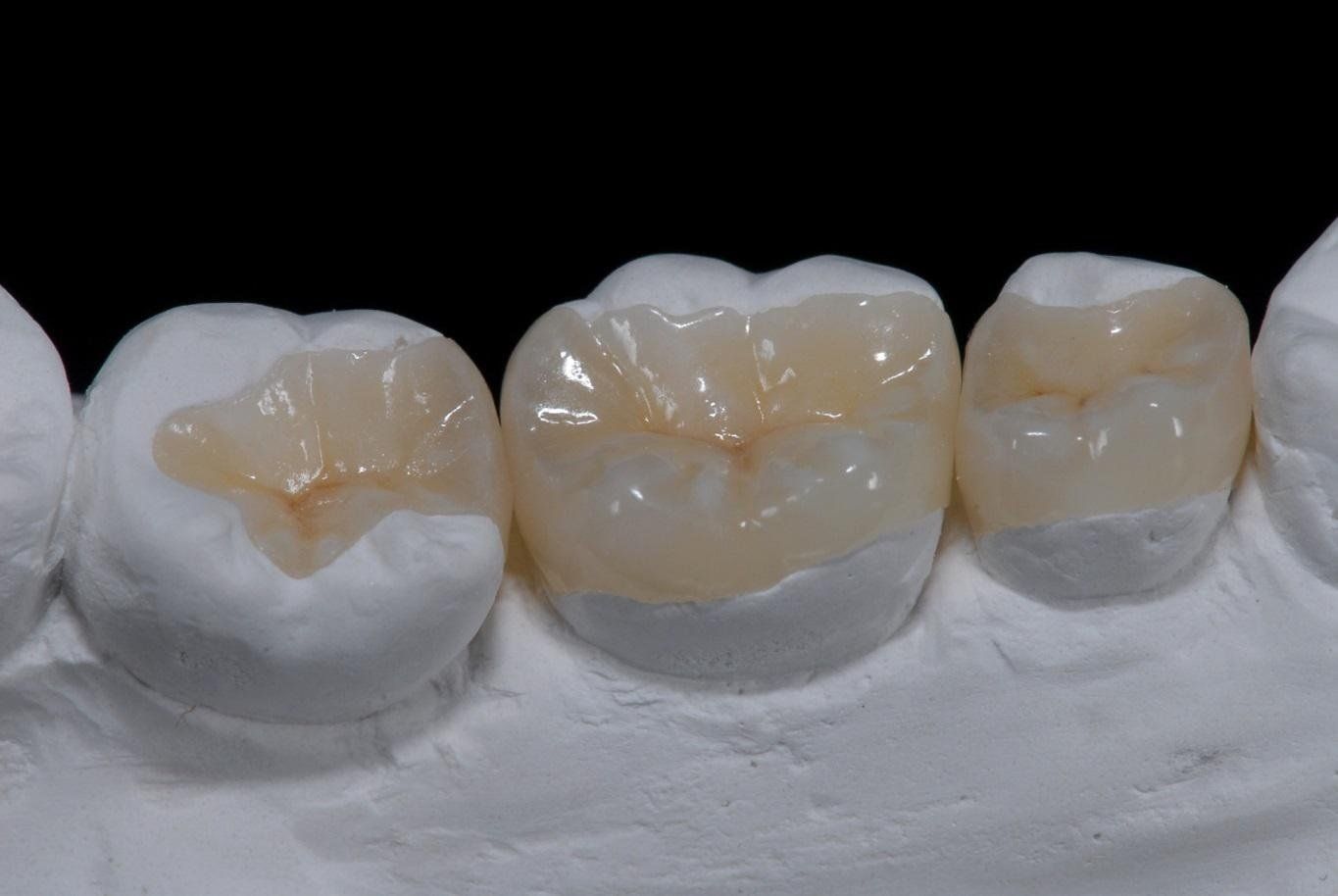 Endodoncia:  Cerec. Radiología digital. Clinica Cámara. Dentista en Granada. Dentista en Jaén