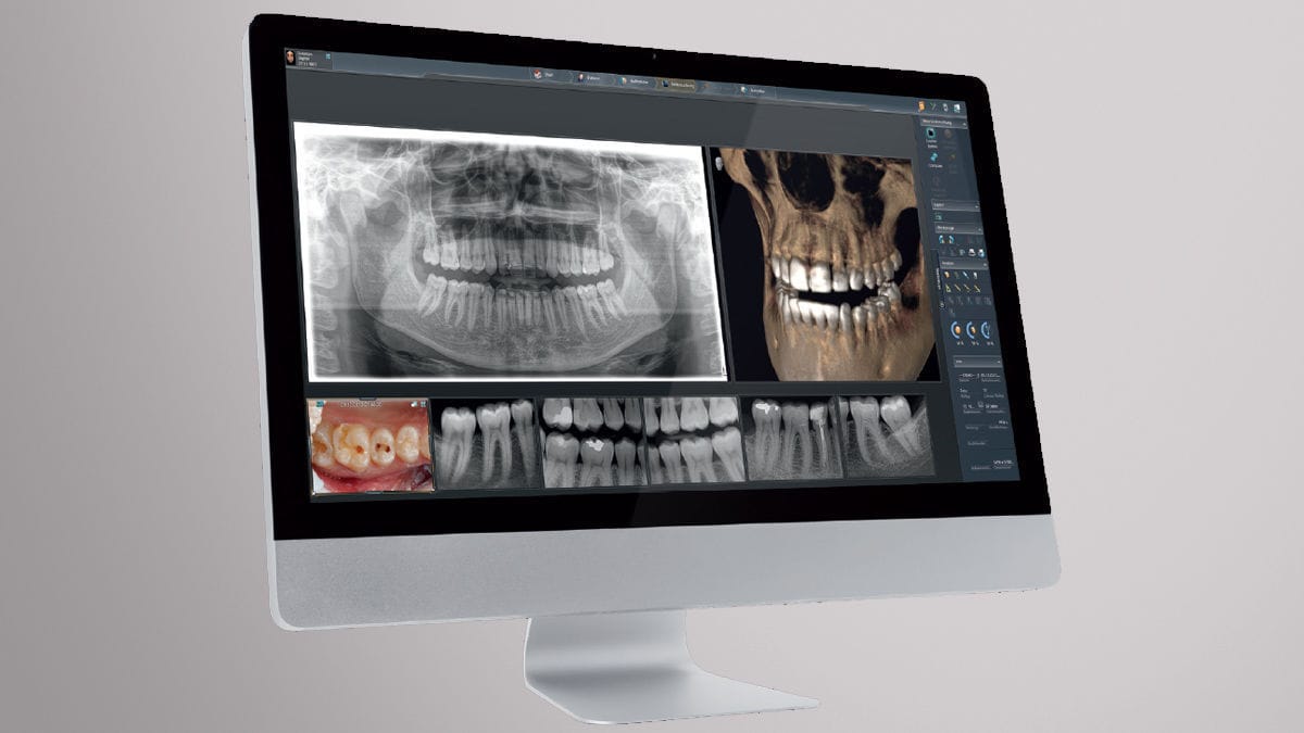 Escaner dental. Radiología 3D dental. Clínica Cámara. Dentista en Granada. Dentista en Jaén.