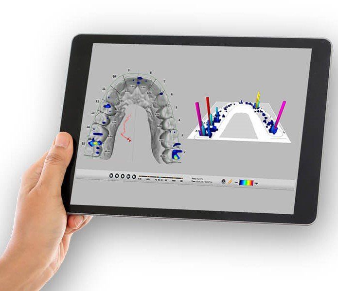 T-Scan. Medición digital de la mordida y oclusión. Clínica Cámara. Dentista Granada. Dentista Jaén.