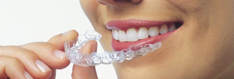 Invisalign. La Ortodoncia Invisible. Clínica Dental Cámara. Dentista en Granada. Dentista en Jaén.