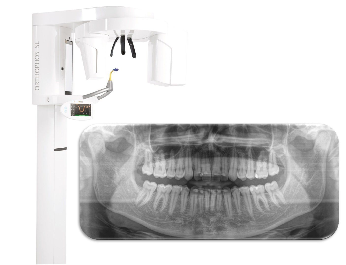 Radiografía panorámica digital. Ortopantomografía digital. Clínica Cámara.  Dentista en Granada. Dentista en jaén.