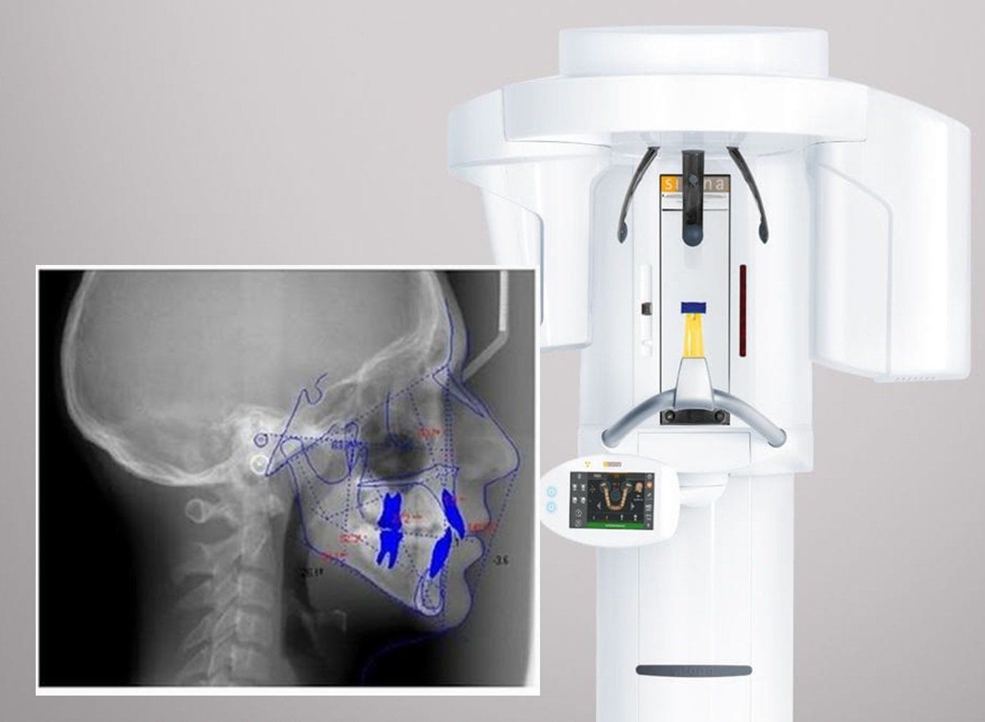 Ortodoncia: Radiología Digital. Clínica Dental Cámara. Dentista en Granada. Dentista en Jaén.