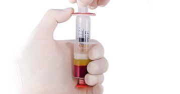 ACP Therapie - Informationen der Orthopädie München Solln