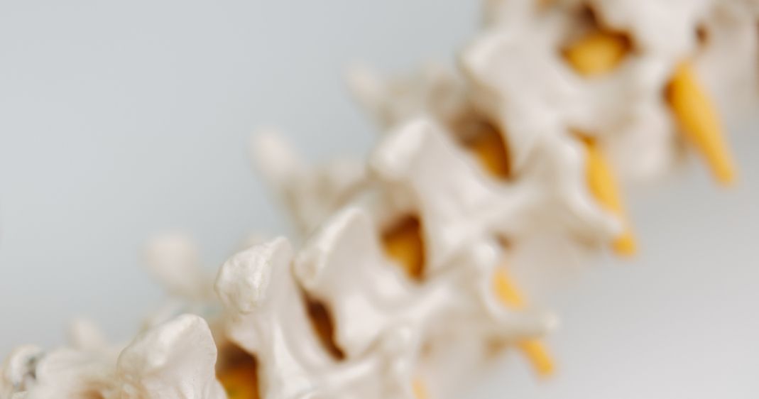 Behandlung Osteoporose in München Solln Privatpraxis Orthopäde