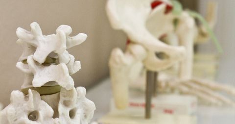 Behandlung Osteoporose in München Solln