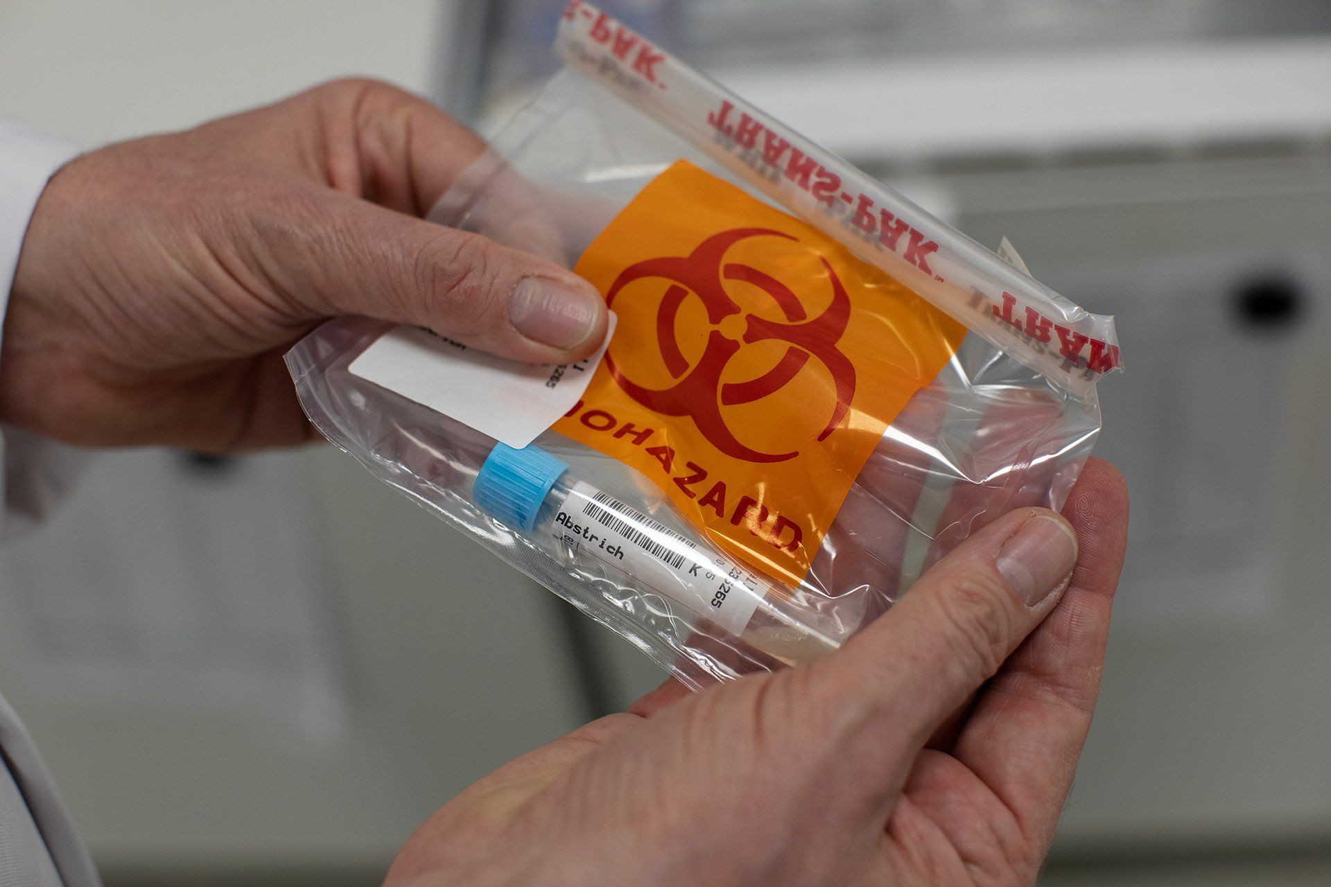 Symbolbild - „Biohazard“ (englisch für „biologische Gefährdung“) steht auf einem Abstrich eines Corona-Verdachtsfalls, der am 26.03.2020 im medizinischen Labor im Klinikum am Finkenhügel in Osnabrück getestet werden. Foto: David Ebener ***Stichworte*** Symbolbild, Symbolfoto, Illustration, Test, Teststreifen, Testset, Test-Set, Probe, Proben, Medizinisches Labor, Klinikum am Finkenhügel, Krankenhaus, Klinik, Gesundheit, Coronavirus, Corona-Virus, Corona Virus, Corona-Virus-Pandemie, SARS-CoV2, COVID-19, Krankheit, Krankheiten, Pandemie, Lungenkrankheit