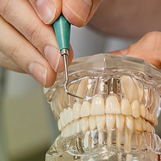 Praxis für Zahnheilkunde Christian Thim Erlensee Zahnarztpraxis Behandlung Leistungen Implantologie Implantate Erlensee Zahnarzt