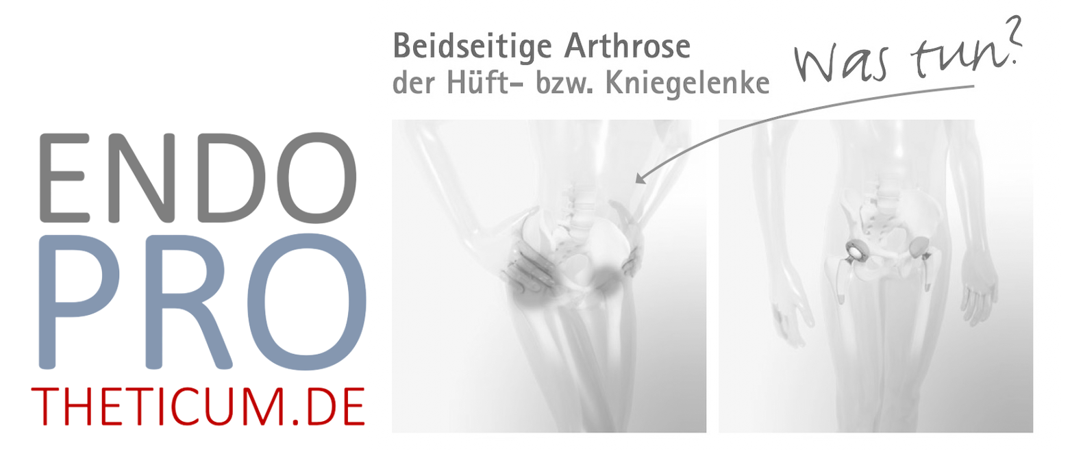 Beidseitige Hüft- oder Knieprothesen in einer OP sind heute bei geeigneten Patienten sicher.