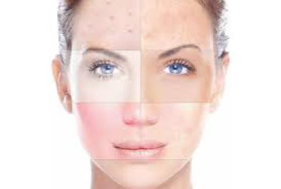 Microdermabrasion