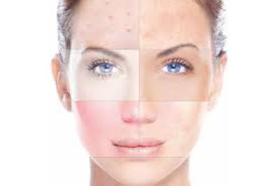 Diamanten - Microdermabrasion