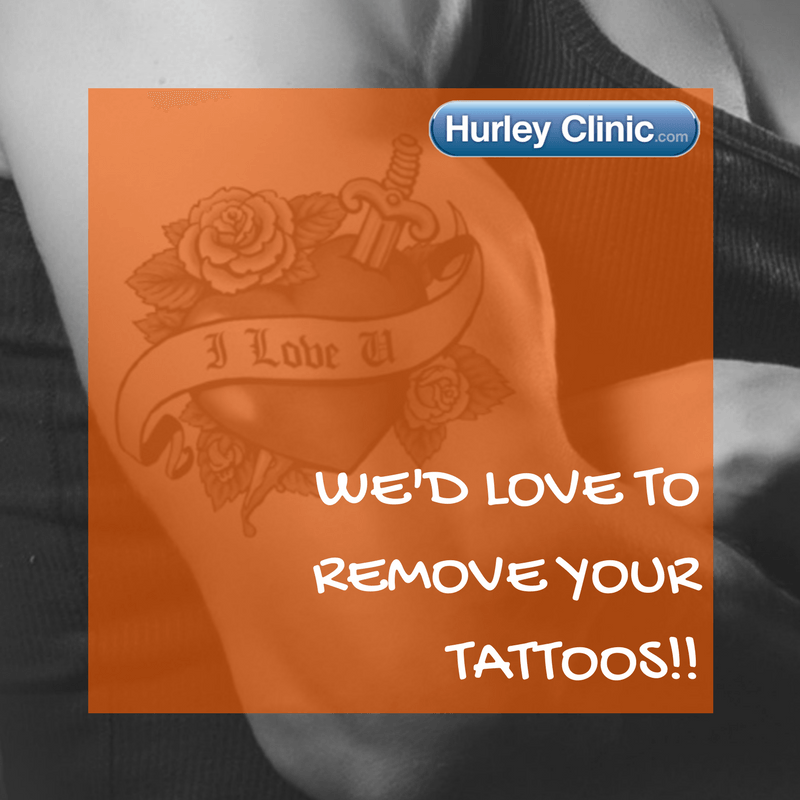 Laser tattoo removal treatment being carried out in clinic