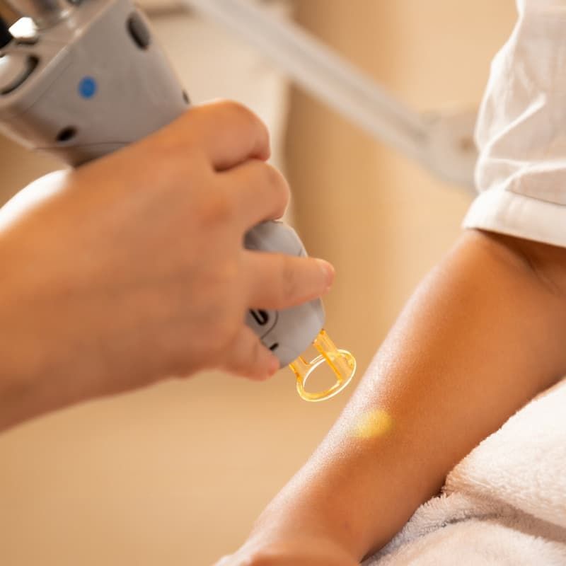 Blog - Epilation Laser Définitive à Melun