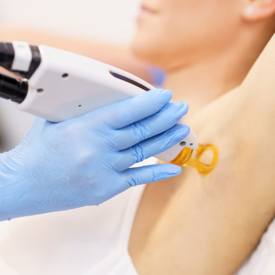 Blog - Epilation Laser au Centre Laser Murano