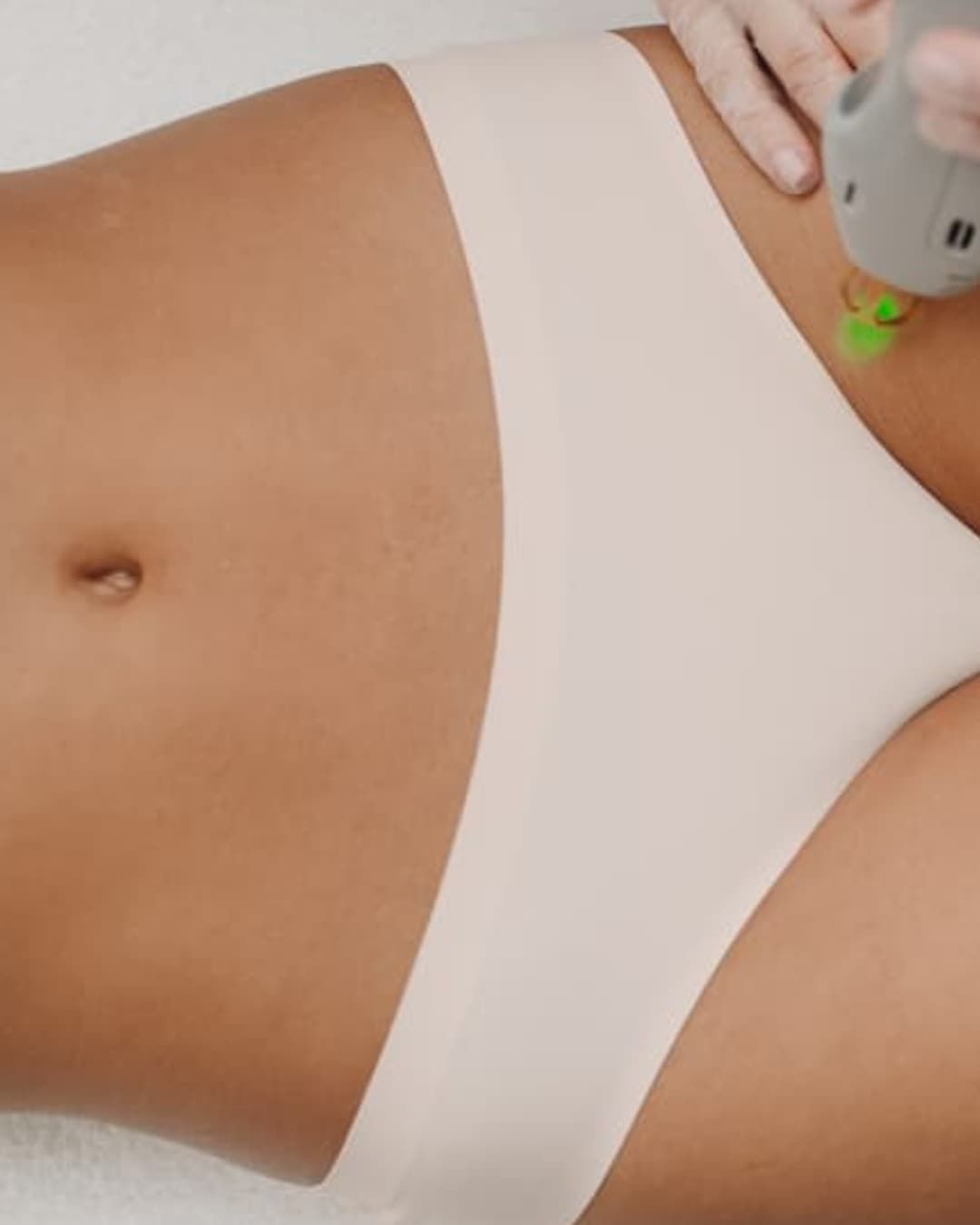 Epilation Laser Maillot - Gentle max pro plus - Murano