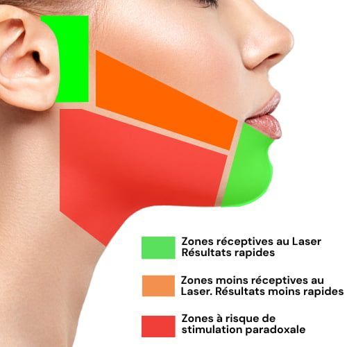 Stimulation paradoxale visage et Cou Electrolyse Centre Laser Murano