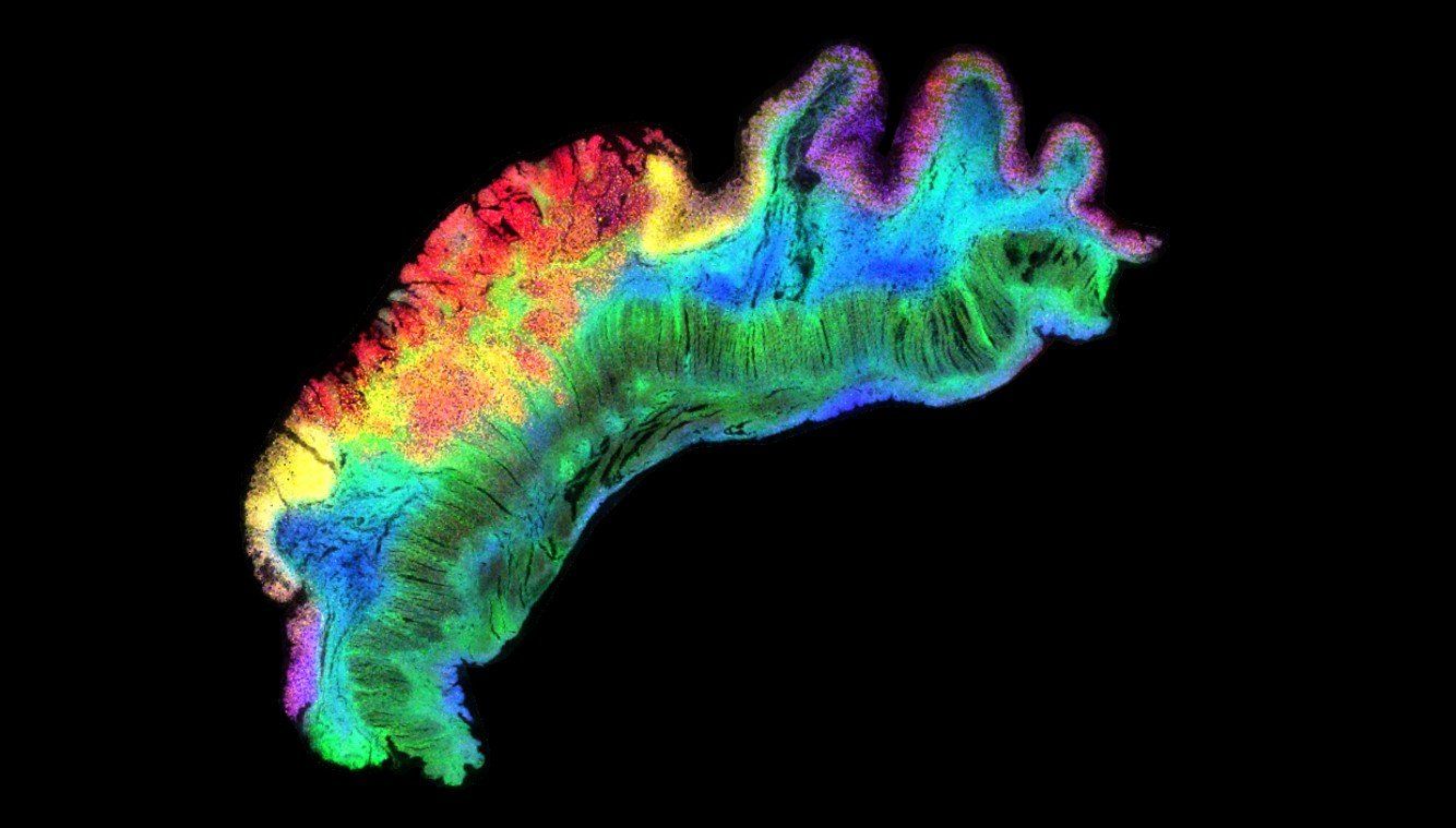 MALDI Mass Spec Imaging