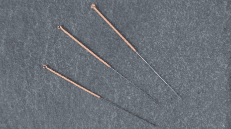 Yoga meets Physio - Akupunktur