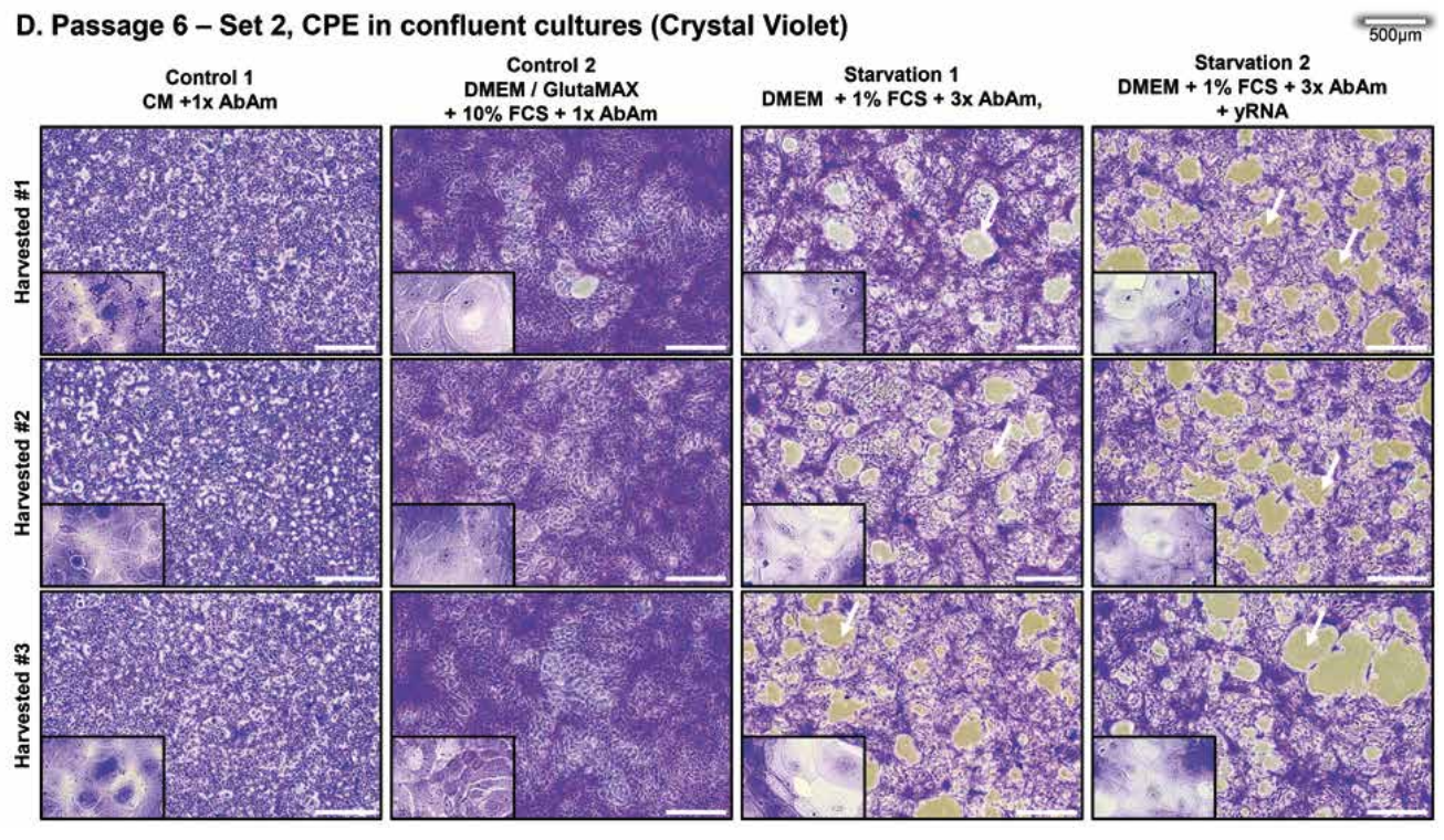 Bhakdi & Palmer im Irrtum