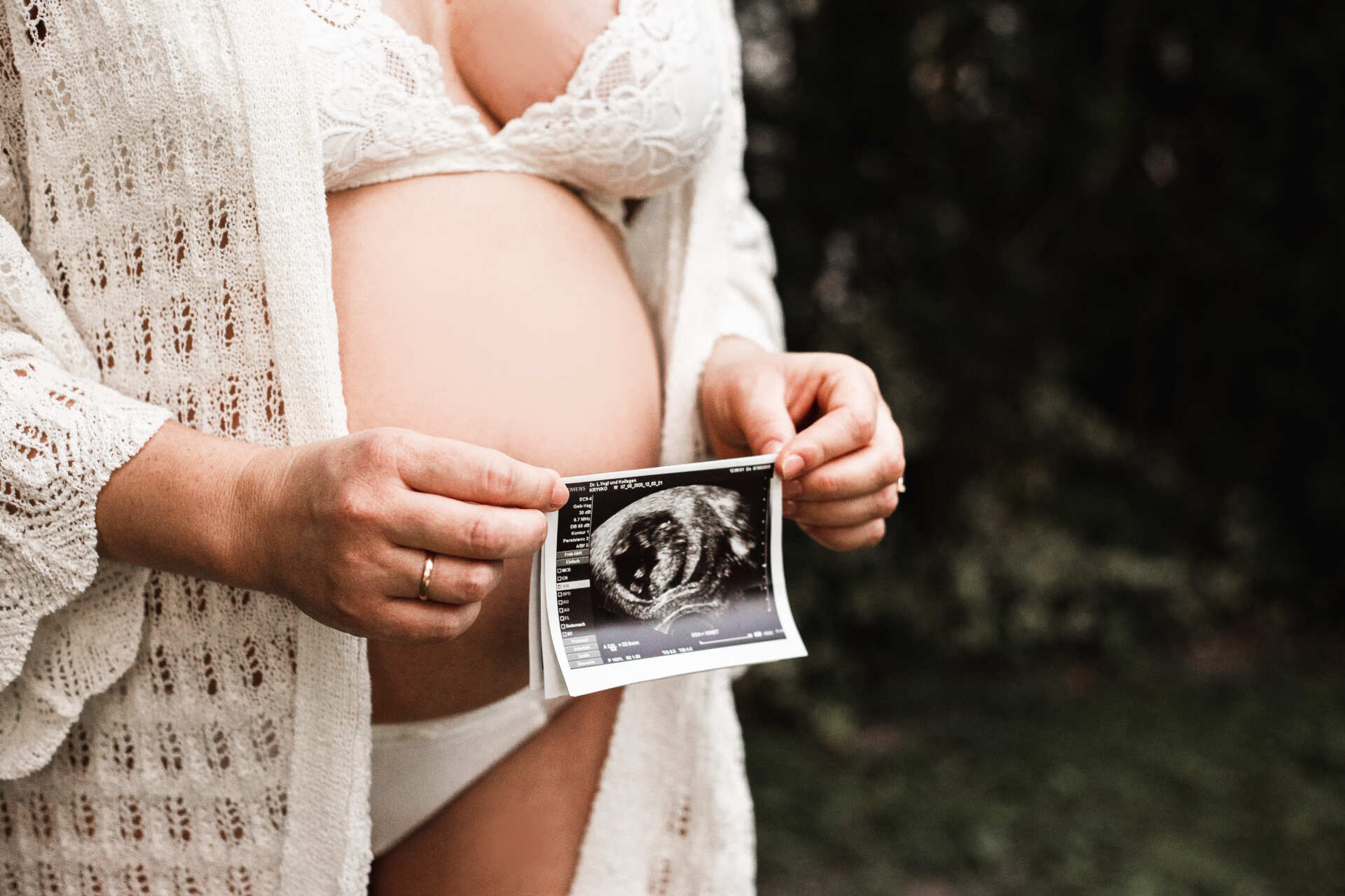 Auf dem Bild hält eine schwangere Frau ein Ultraschallbild