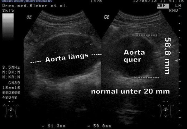 Untersucher: Dr. Gerhard Kraus, 2013