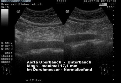 Untersucher: Dr. Gerhard Kraus, 2013
