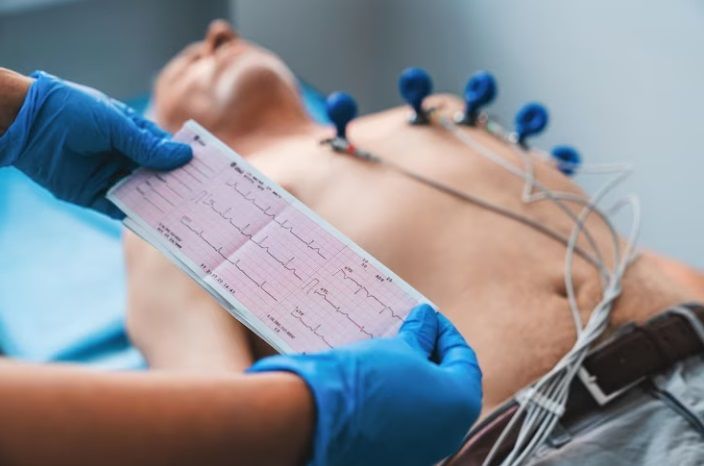 Electrocardiógrafos profesionales para clínicas, hospitales y consultas médicas