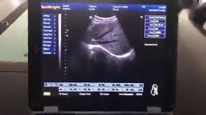 Servicio tecnico electromedicina