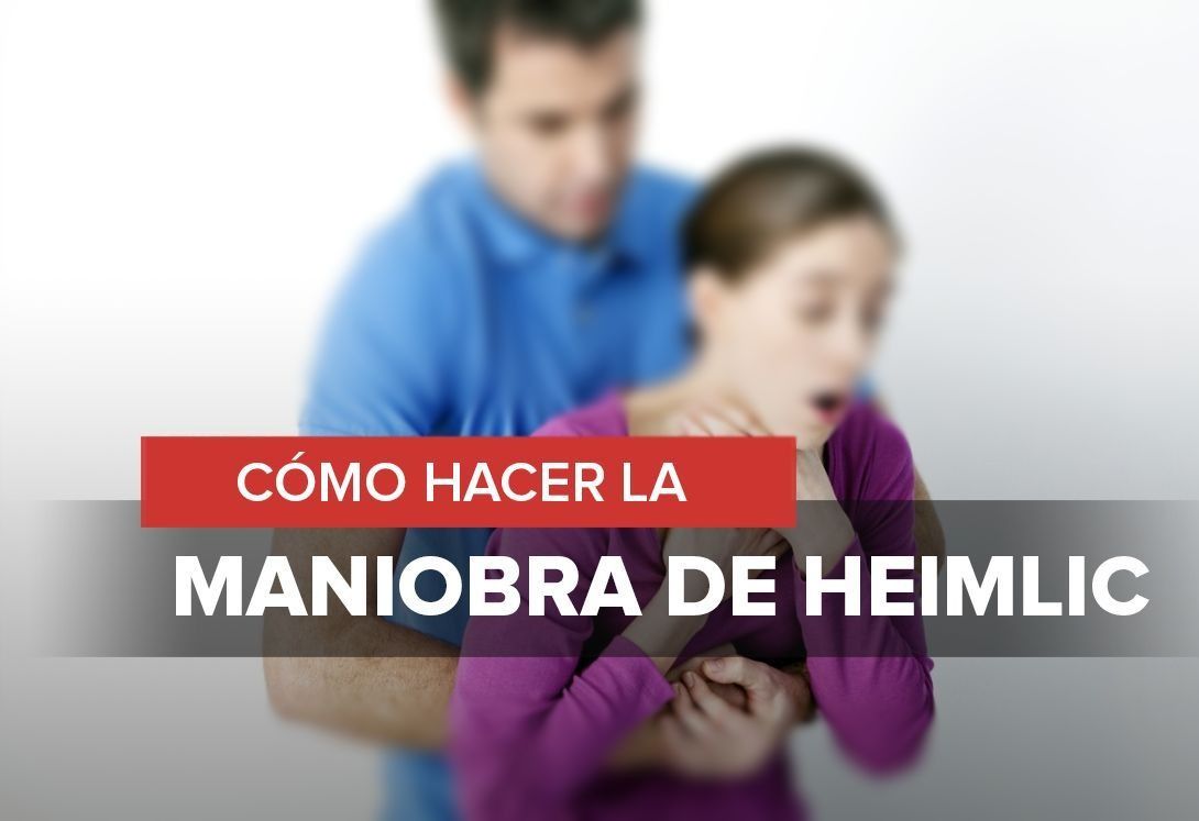 Maniobra de heimlich como realizar la Maniobra de heimlich