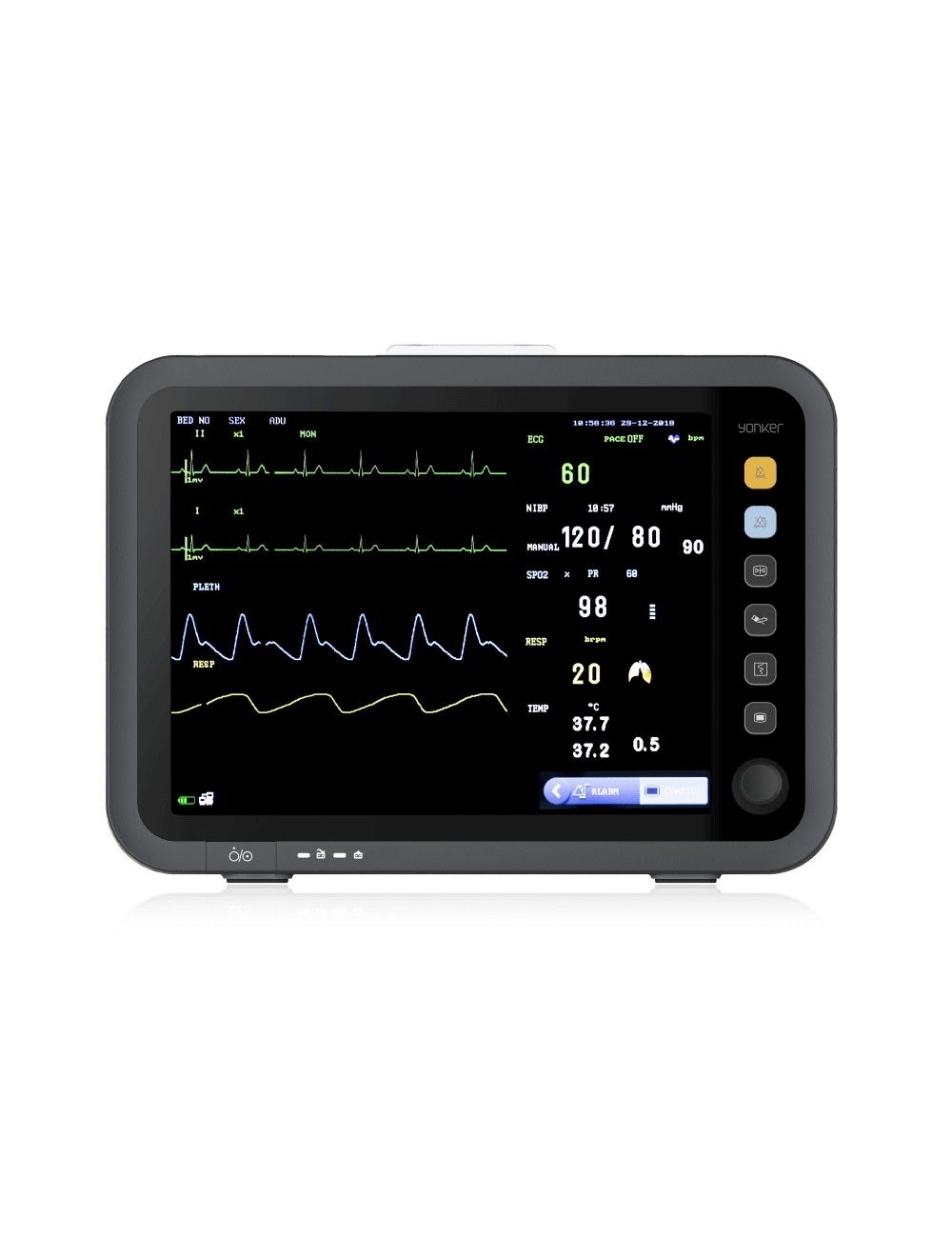 Monitor de paciente 12 pulgadas modelo E12 con impresora integrada
