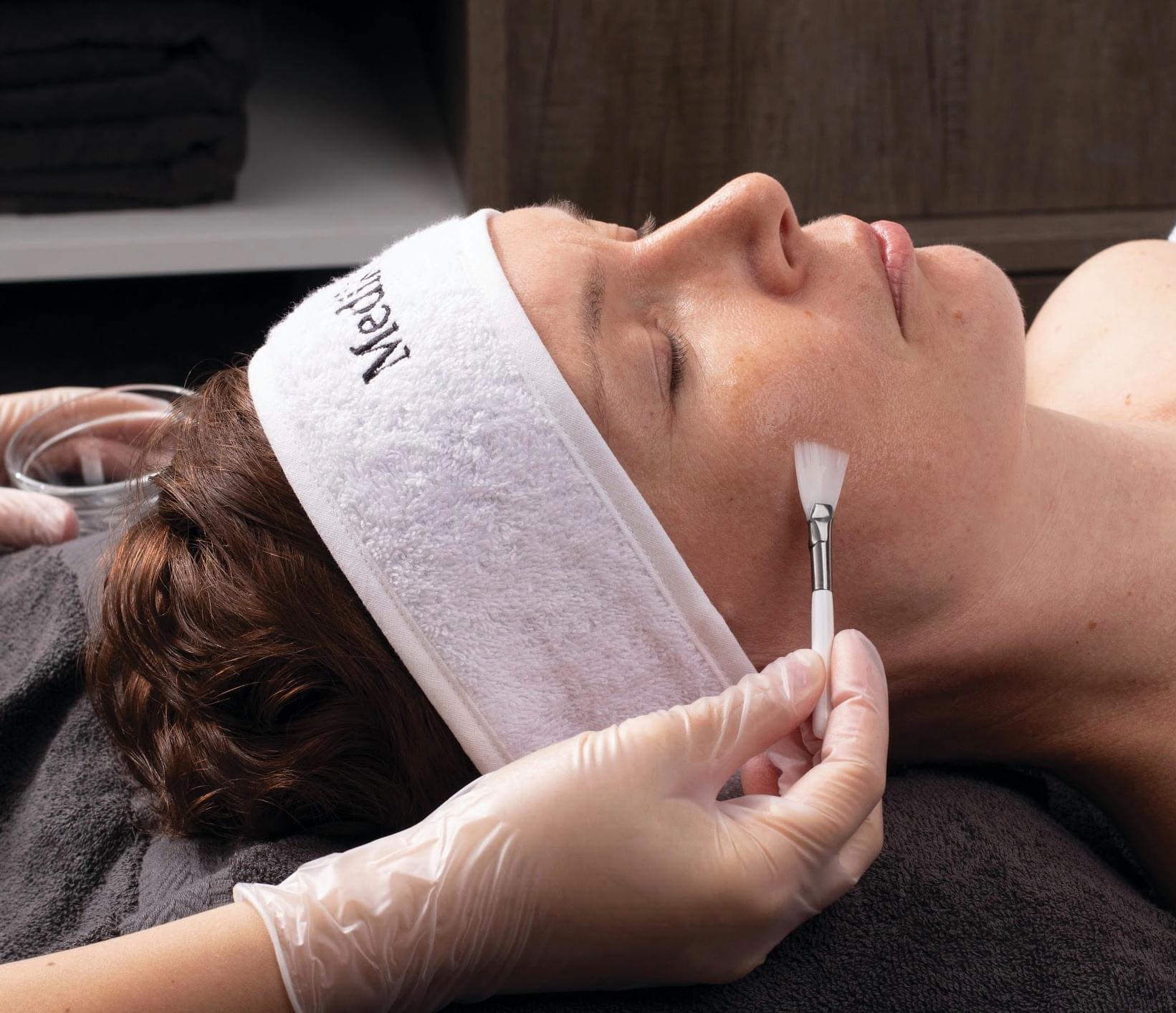 Chemical Peels Alsager Clinic