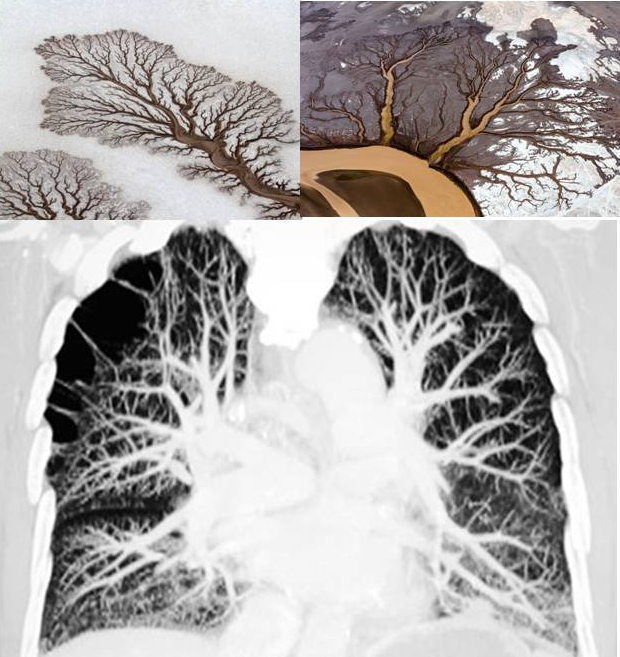 comme un estuaire, les poumons radiographie des poumons, estuaire