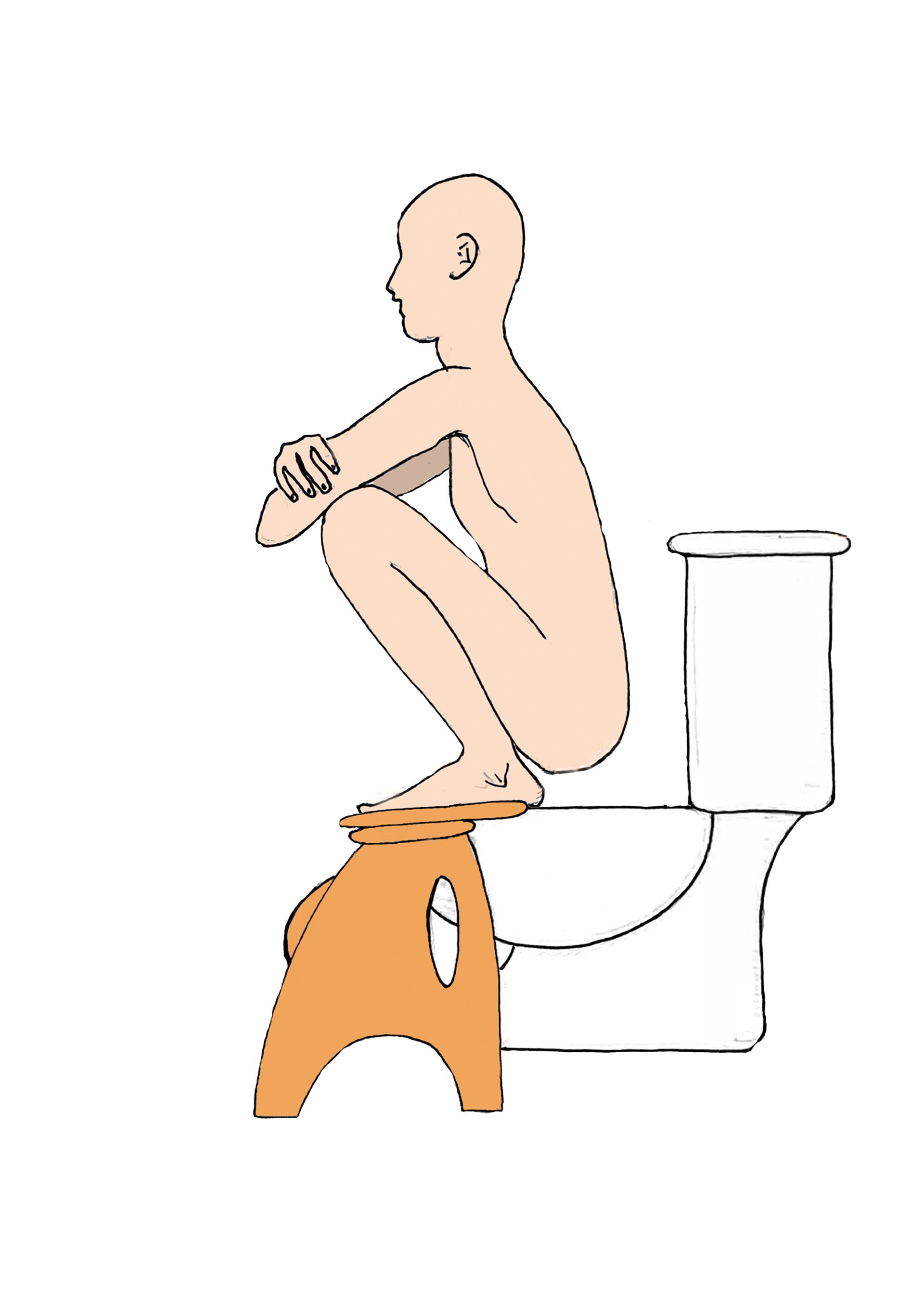 Estreñimiento, hemorroides