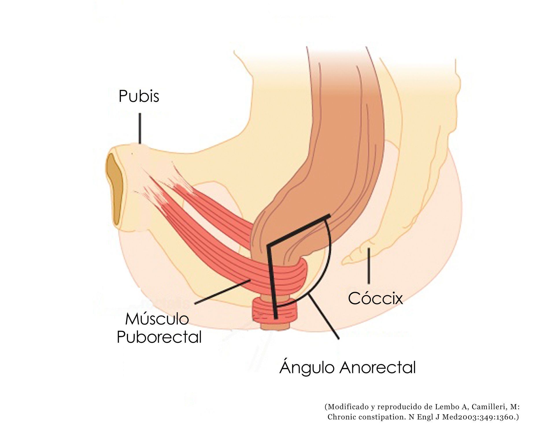 Estreñimiento, hemorroides