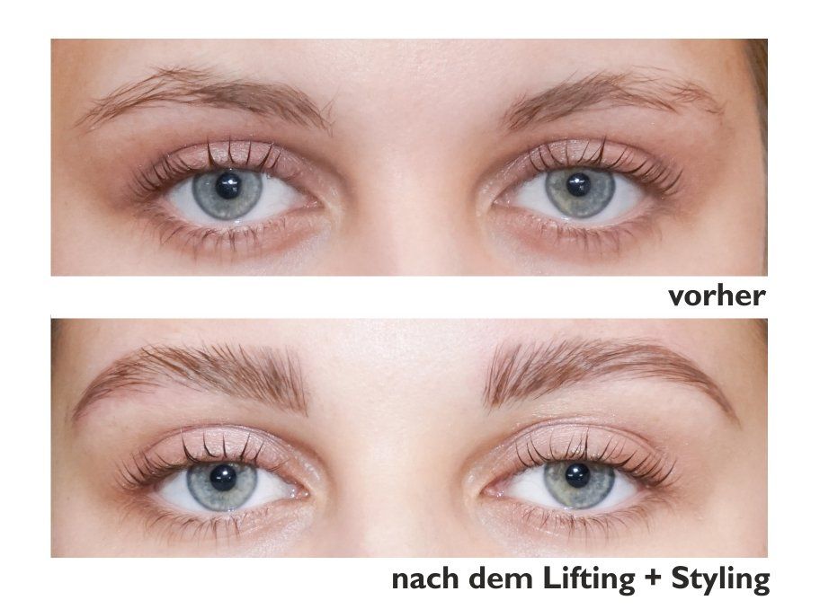 Browlifting Browlifting