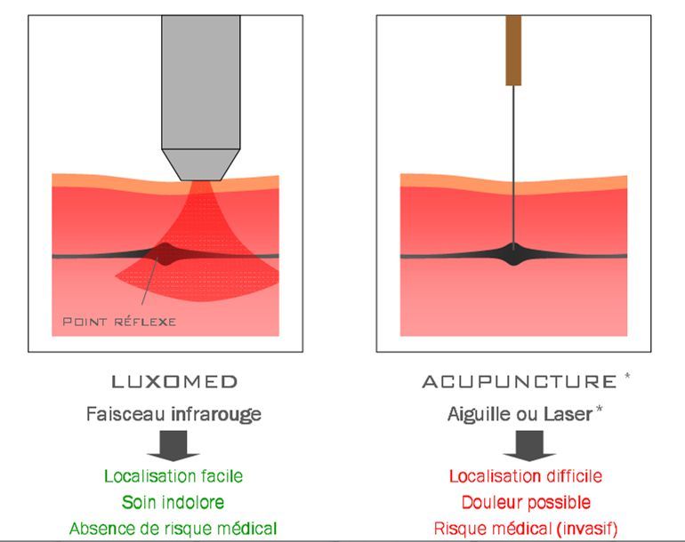 Explication faisceau infra-rouge