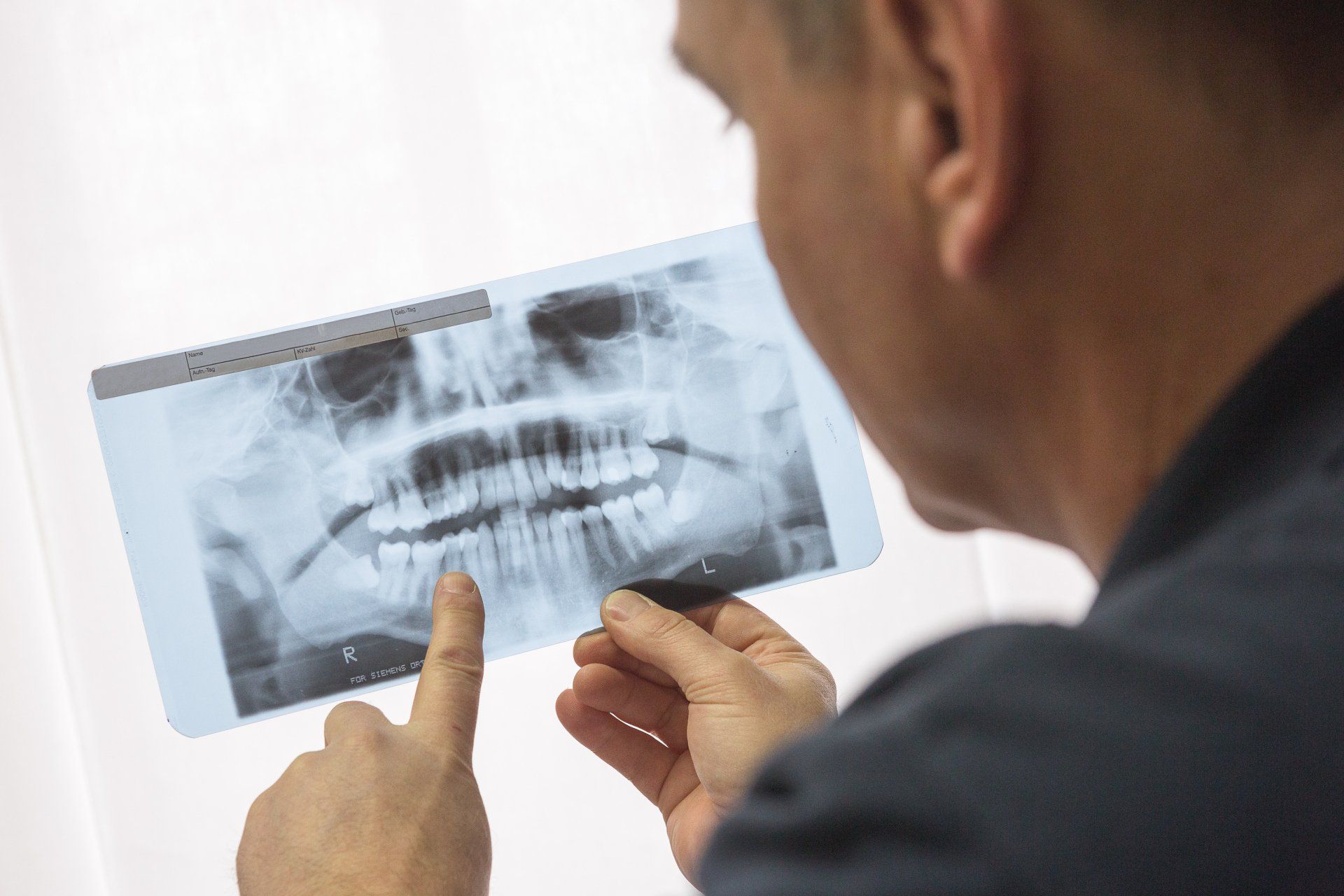 Zahnarzt begutachtet Röntgenbild