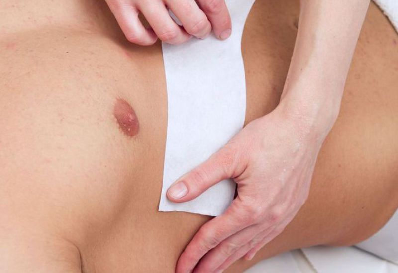 Man receiving chest hair removal services
