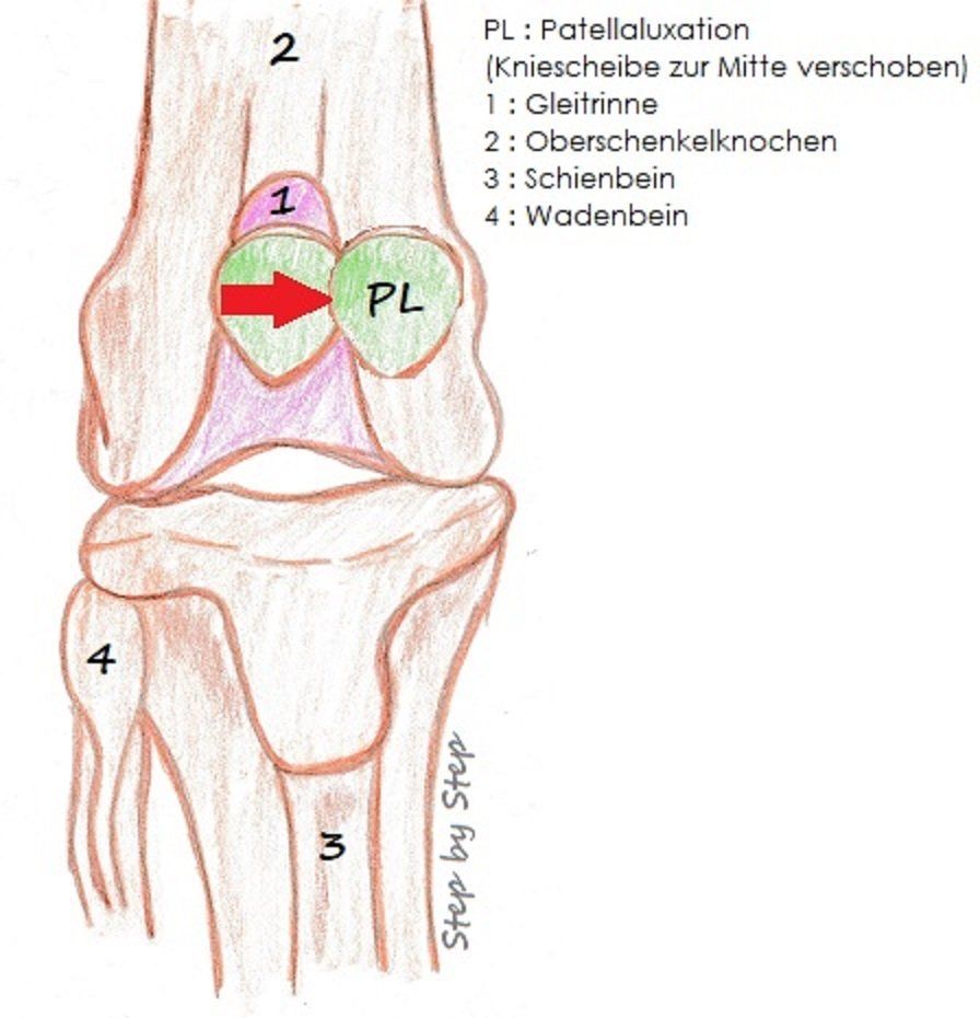 Step by Step - Tierphysiotherapie Hannover Sina Gratzke Patellaluxation
