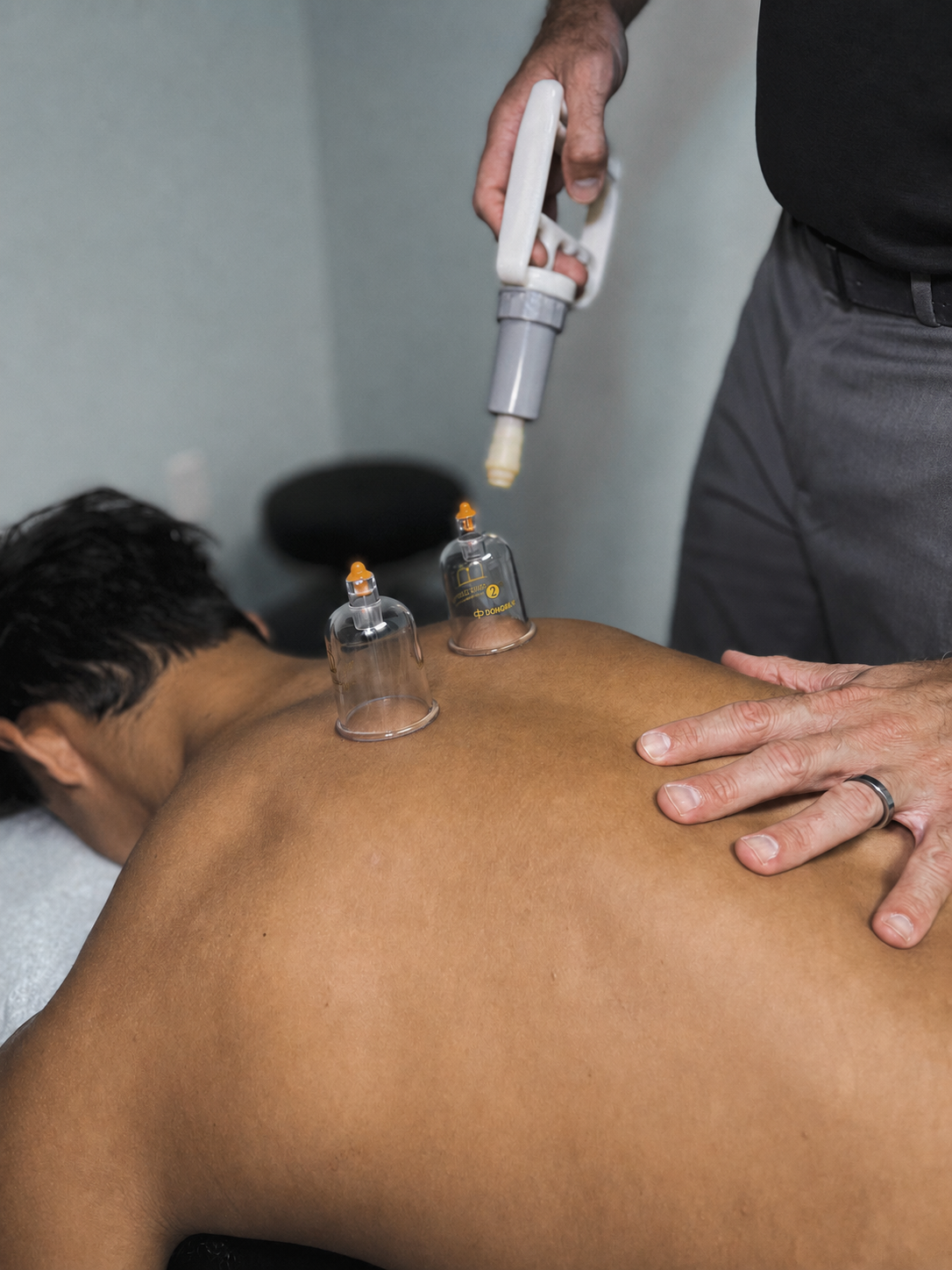 Cupping therapy for myofascial release at Performance Driven Therapy Centers