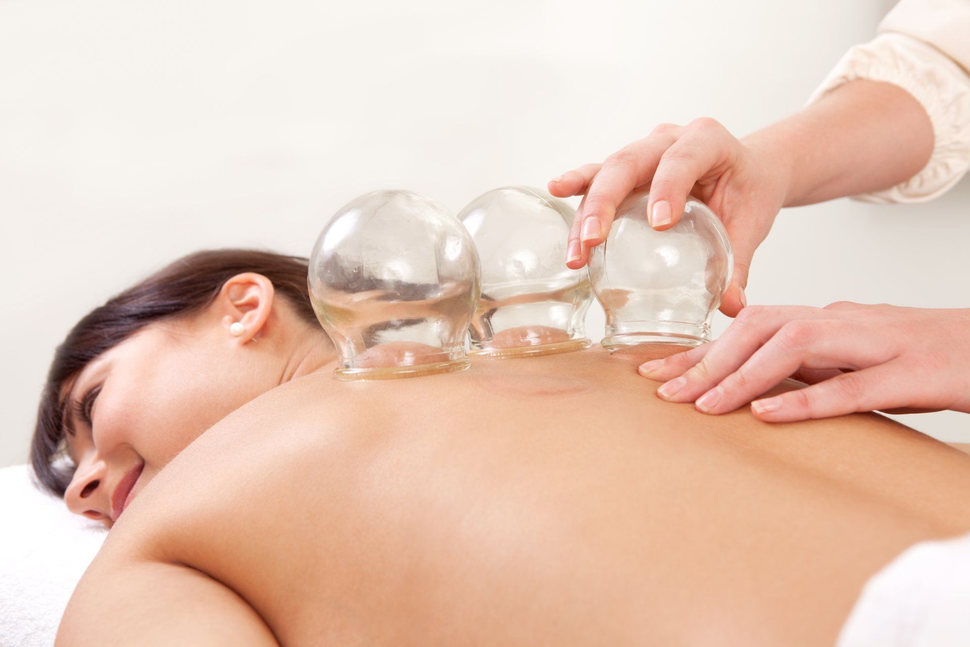 Cupping | GAOM