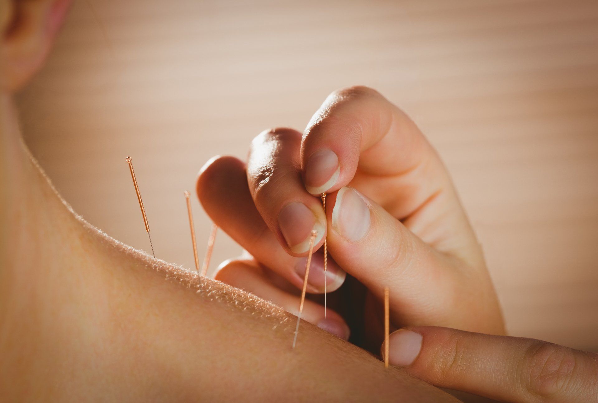 Acupuncture | GAOM