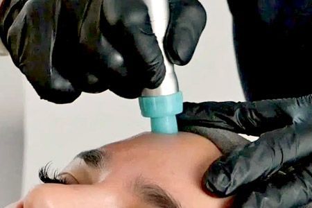 Aqua Facial Behandlung in Großaufnahme