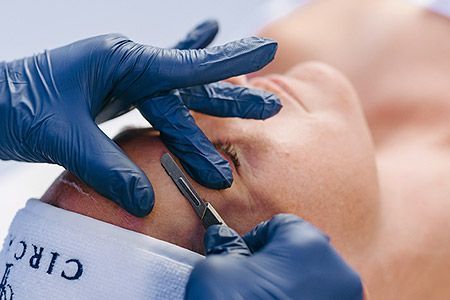 Gesichtsbehandlung Dermaplaning
