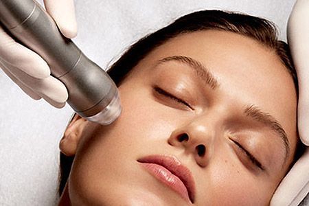 Gesichtsbehandlung mit einem Micro Needling Handstück