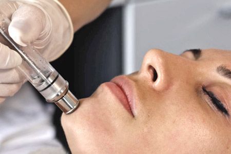 Gesichtsbehandlung mit Mikrodermabrasions-Handstück
