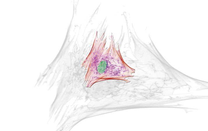 Arthrofibrose-KombinationsTherapie n. Domanski Arthrofibrose-KombinationsTherapie n. Domanski