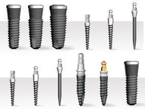 Mini-Implantate Zahnarztpraxis Dres. Birgit und Bertram Winkler Mini-Implantate Zahnarztpraxis Dres. Birgit und Bertram Winkler