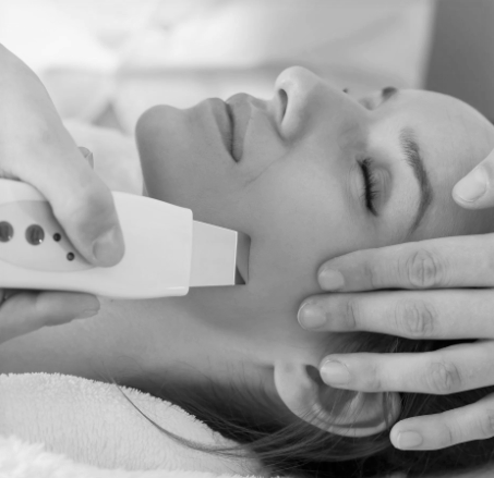 Microneedling