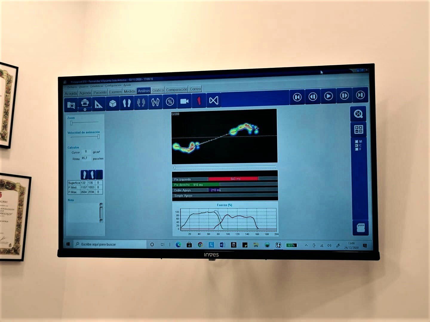 Visionado estudio de la pisada