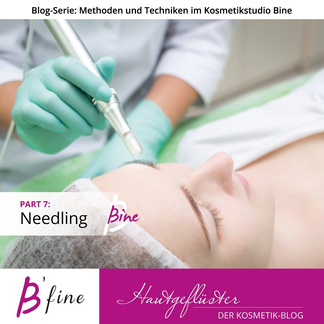 Perforation ist Regeneration durch Stimulation = Needling Needling - Kosmetische Anwendung